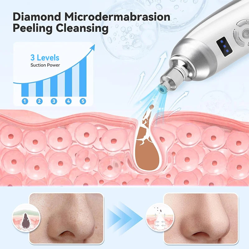 Upgraded Diamond Microdermabrasion Machine Blackhead Removal